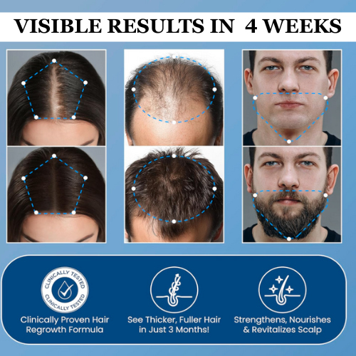 Lustrelle Hair Growth Roll on Serum