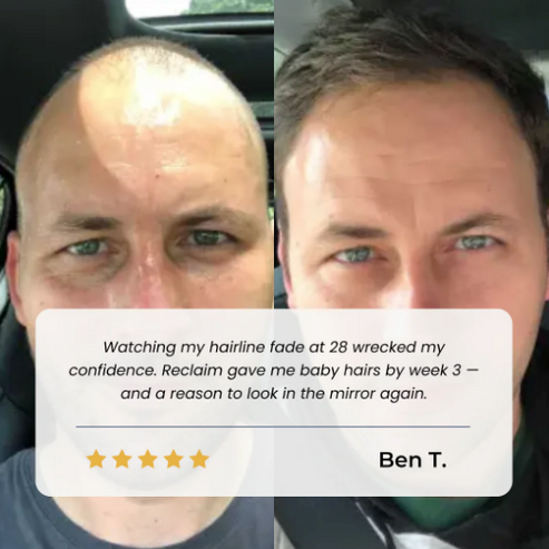 Lustrelle Hair Growth Roll on Serum